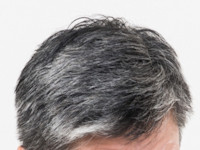 白髪が急に増える原因とは？40代で白髪が増えてきた男性の対策